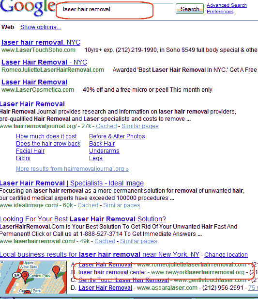 laser hair removal google