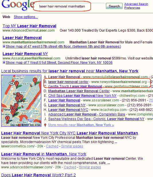 laser hair removal Manhattan Google